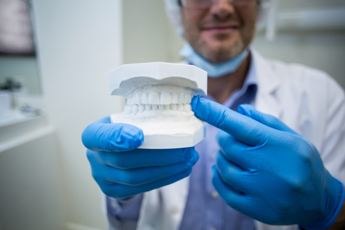Dentist holding a mouth model in dental clinic