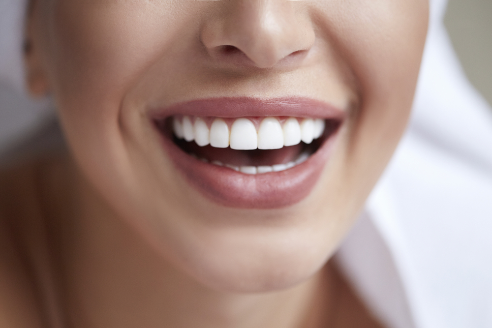 Healthy white smile close up