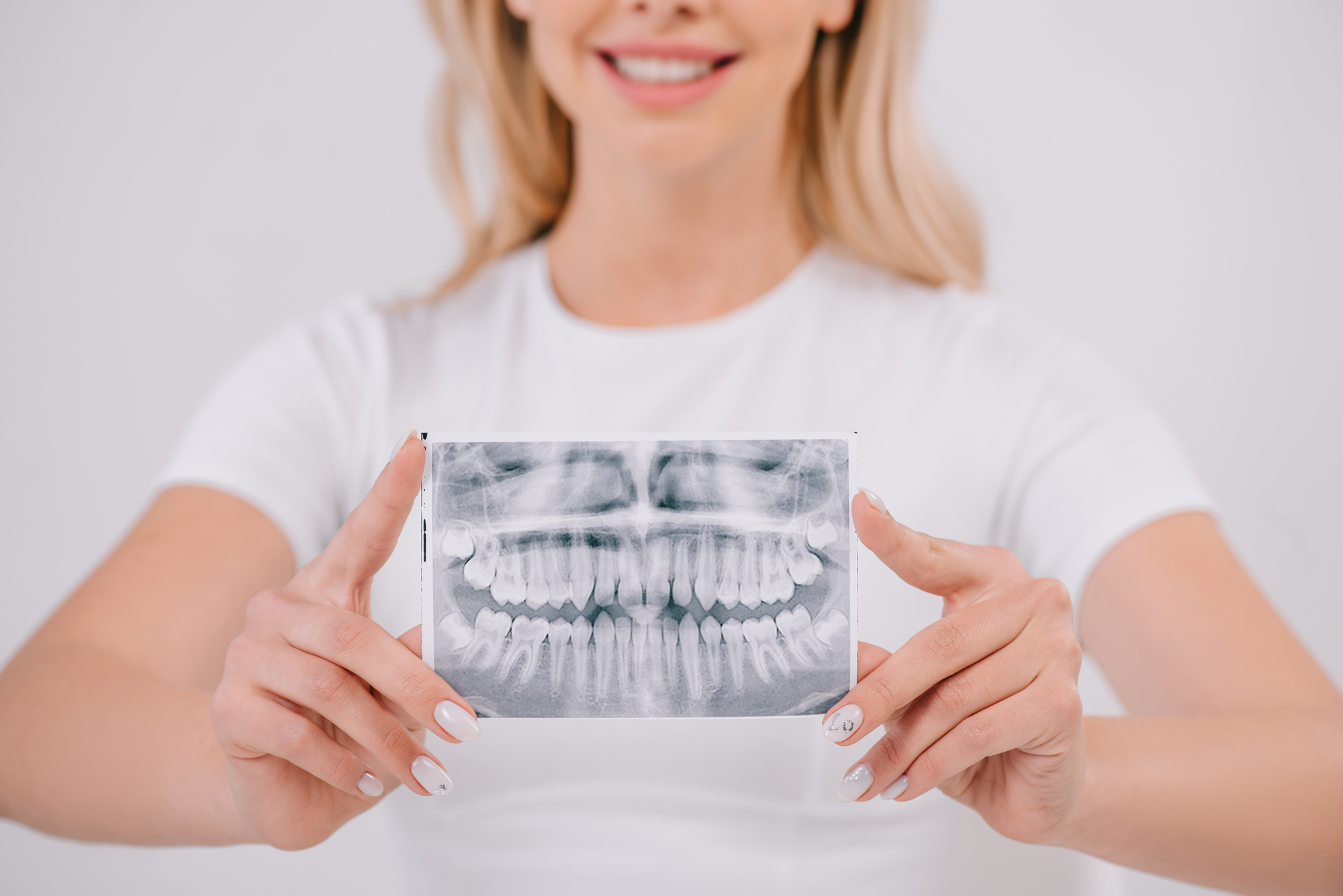 Woman with healthy teeth holding dental x-ray