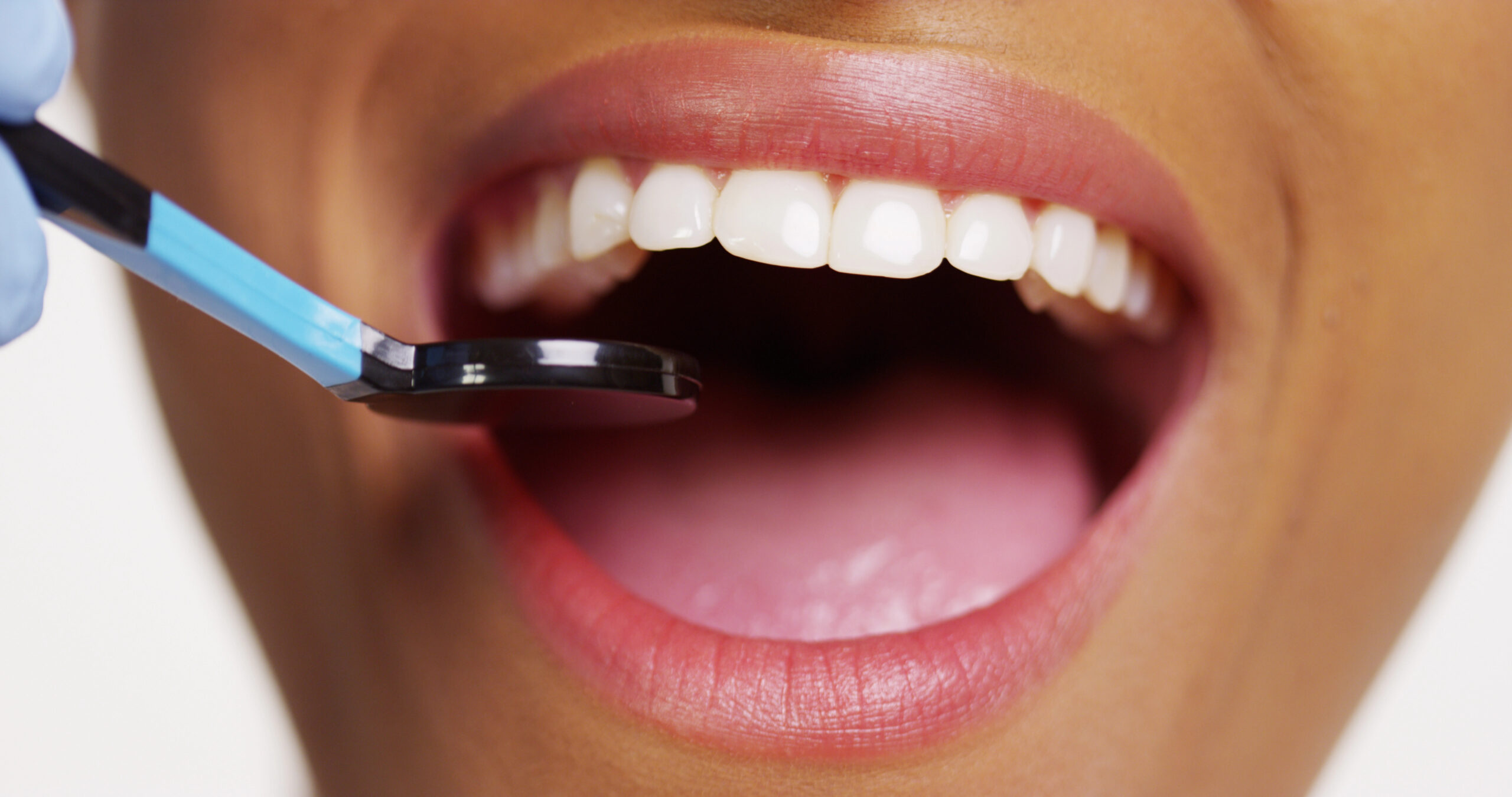 Close up of woman's mouth getting dental screening.