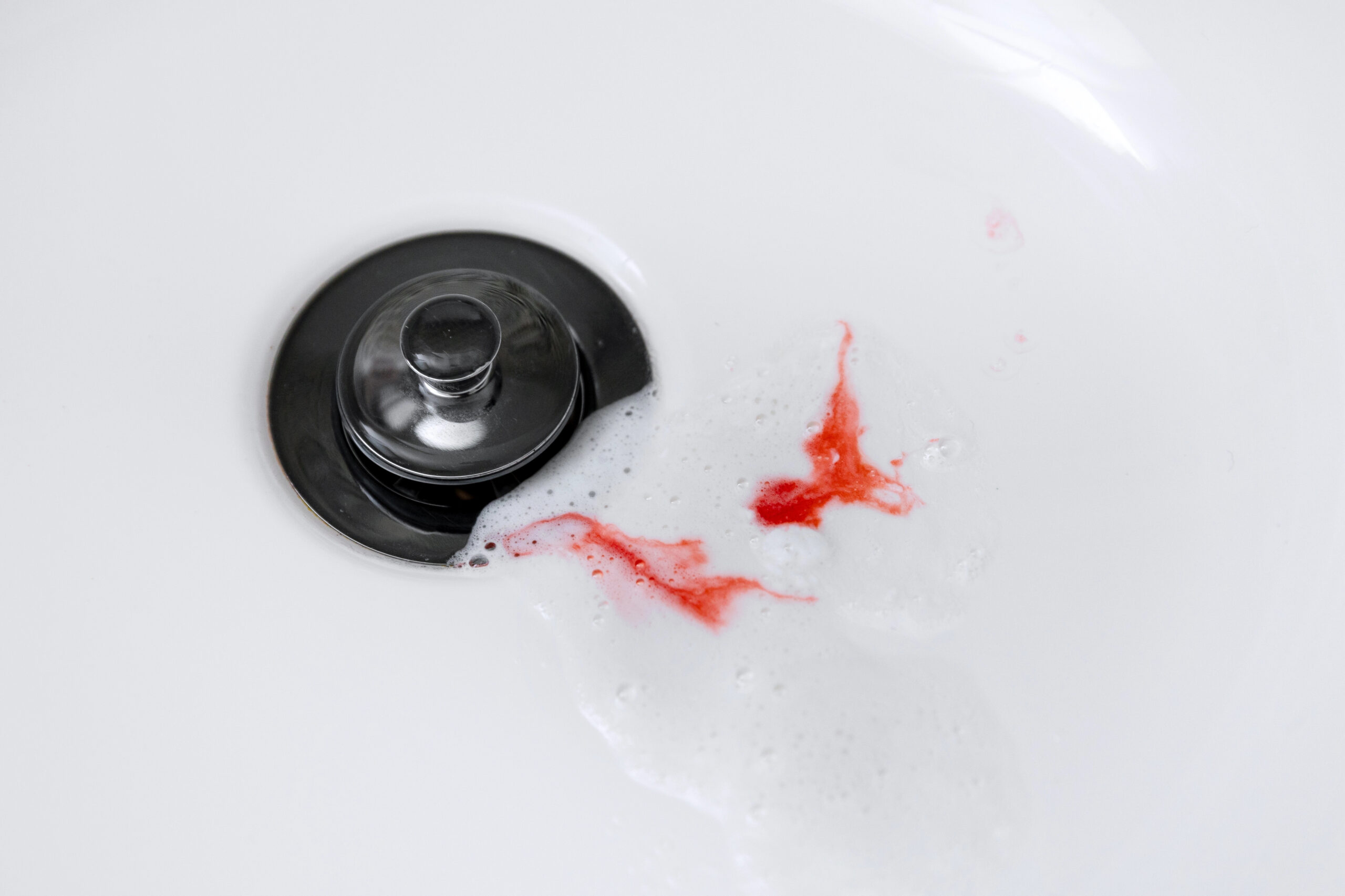 Sink with blood from bleeding gums. 
