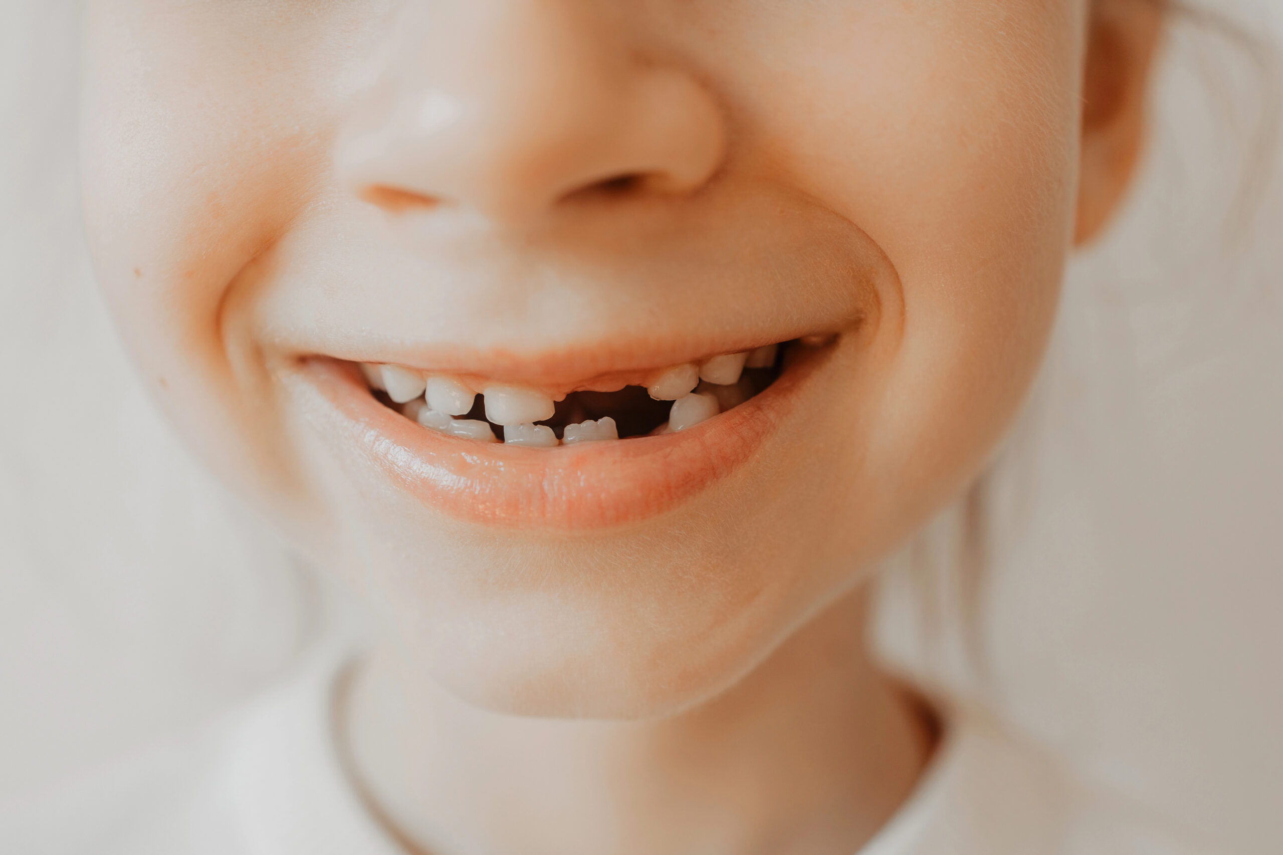 Close up of child with missing baby teeth